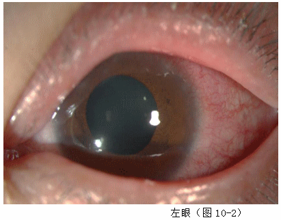 ZY016_46_3.gif